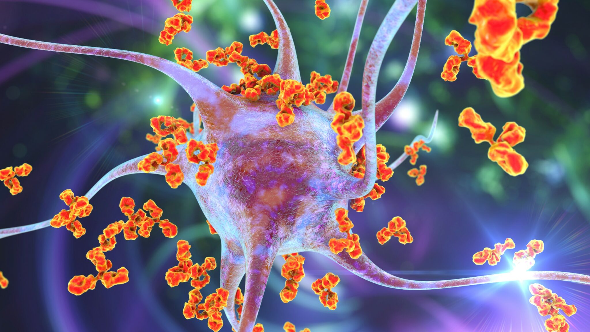 Autoimmune Diseases That Cause Seizures A Comprehensive Guide Maggie