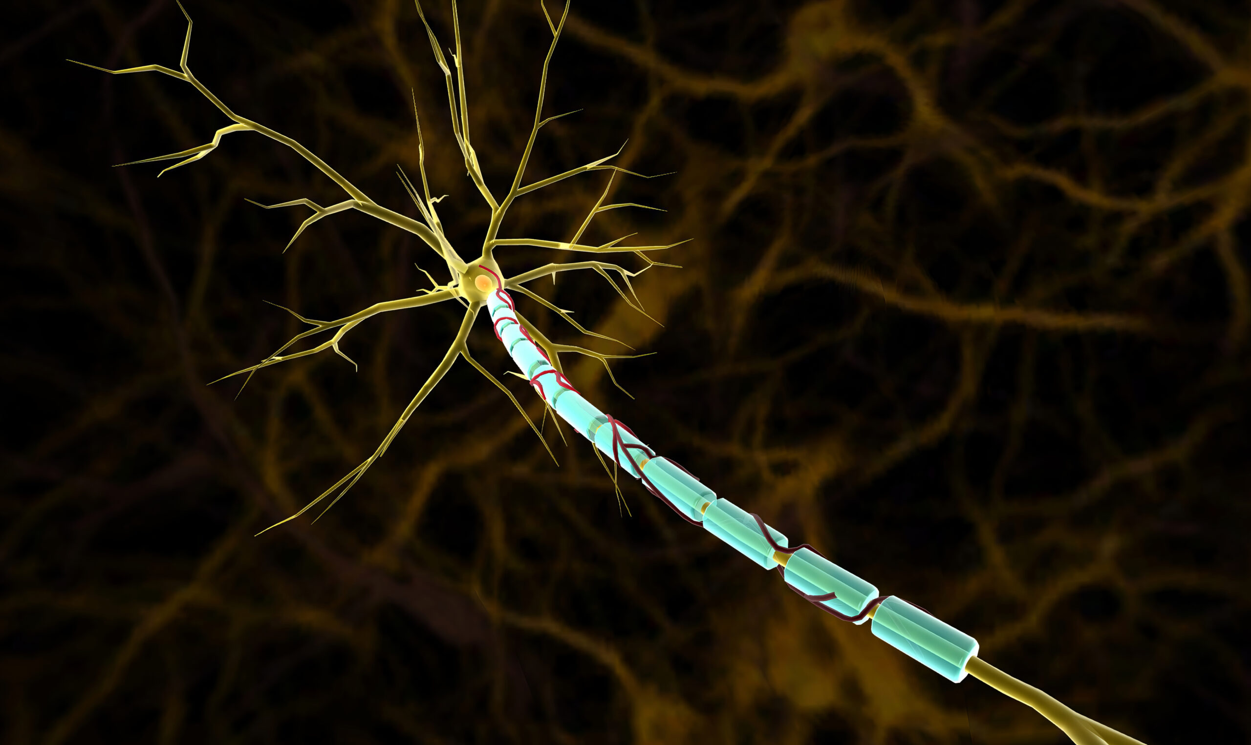 Featured image for “Neurological Autoimmune Diseases: The Complexities”